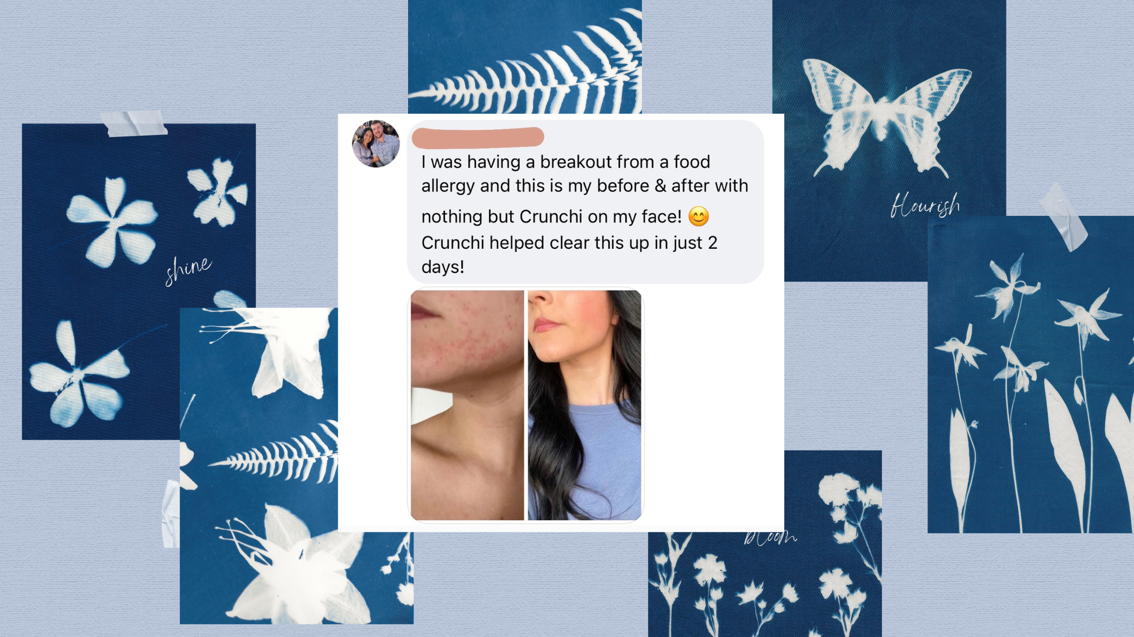 Before-and-after selfie showing a client’s allergic breakout clearing dramatically using only Crunchi products.
